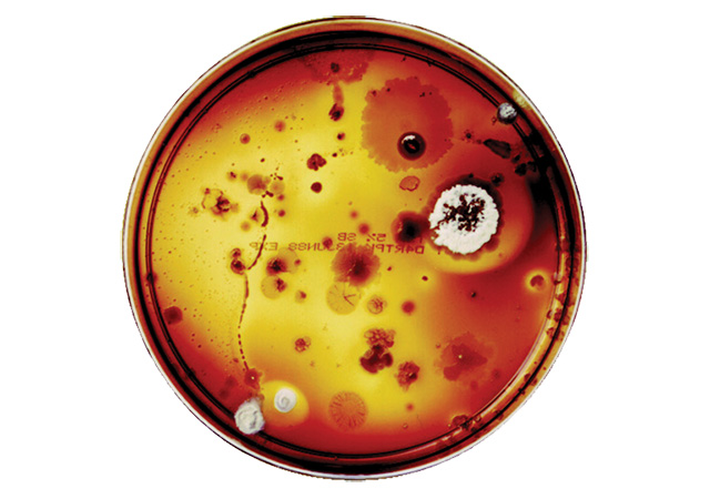 Bacteria Before